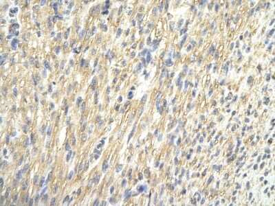 Immunohistochemistry: CDK4 Antibody [NBP2-32288]