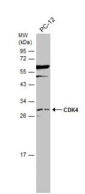 Western Blot: CDK4 Antibody [NBP1-31308]