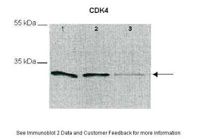 Western Blot: CDK4 Antibody [NBP2-32288]