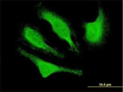 Immunocytochemistry/ Immunofluorescence: CDK5 Activator 1 Antibody (4G11) [H00008851-M01]