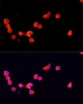 Immunocytochemistry/ Immunofluorescence: CDK5 Activator 1 Antibody - Azide and BSA Free [NBP2-92622]