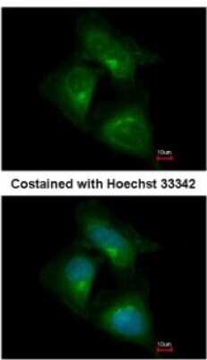 Immunocytochemistry/ Immunofluorescence: CDK5RAP1 Antibody [NBP2-15844]