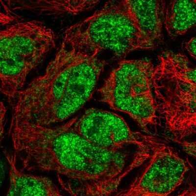 Immunocytochemistry/ Immunofluorescence: CDK5RAP1 Antibody [NBP2-55839]