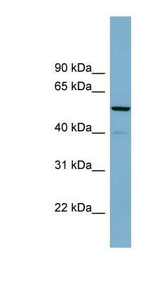 Western Blot: CDK5RAP1 Antibody [NBP1-58246]