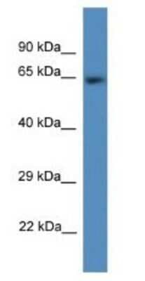 Western Blot: CDK5RAP1 Antibody [NBP1-79651]