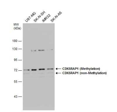 Western Blot: CDK5RAP1 Antibody [NBP2-15844]