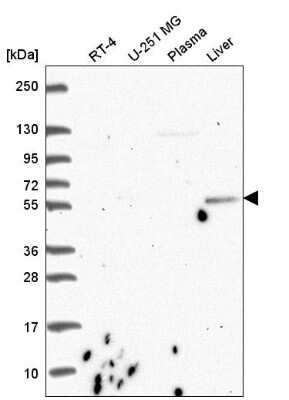 Western Blot: CDK5RAP1 Antibody [NBP2-55839]