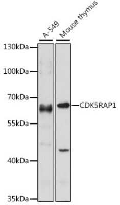 Western Blot: CDK5RAP1 AntibodyAzide and BSA Free [NBP2-92870]