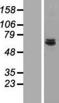 Western Blot: CDK5RAP1 Overexpression Lysate [NBL1-09042]