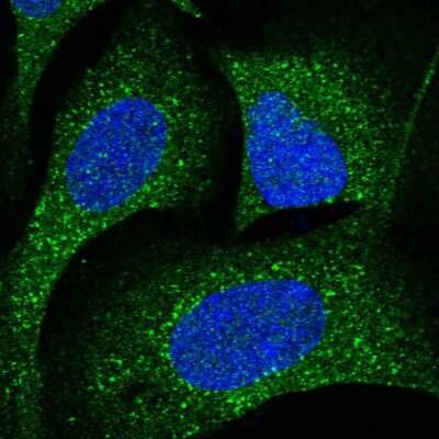 Immunocytochemistry/ Immunofluorescence: CDK5RAP3 Antibody [NBP1-86778]