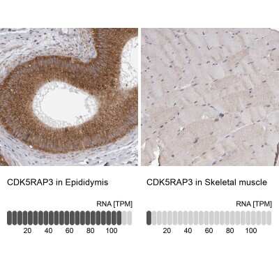 Immunohistochemistry-Paraffin: CDK5RAP3 Antibody [NBP1-86778]