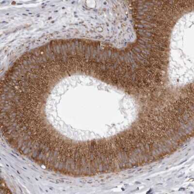 Immunohistochemistry-Paraffin: CDK5RAP3 Antibody [NBP1-86778]
