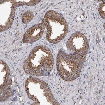 Immunohistochemistry-Paraffin: CDK5RAP3 Antibody [NBP1-86778]