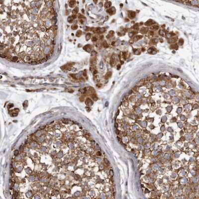 Immunohistochemistry-Paraffin: CDK5RAP3 Antibody [NBP1-86778]