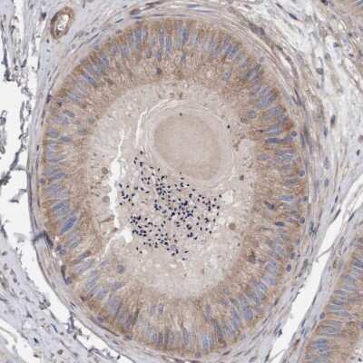 Immunohistochemistry-Paraffin: CDK5RAP3 Antibody [NBP1-86779]