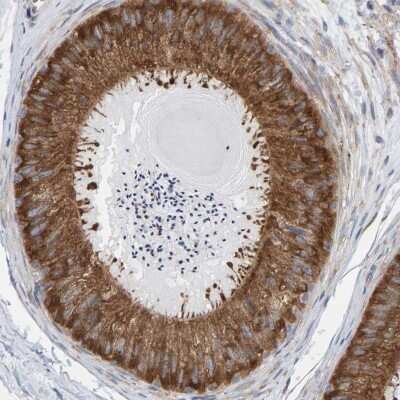 Immunohistochemistry-Paraffin: CDK5RAP3 Antibody [NBP1-86780]