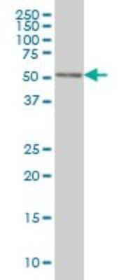 Western Blot: CDK8 Antibody (2E6) [H00001024-M04]