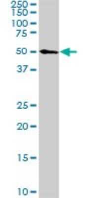 Western Blot: CDK8 Antibody (2E6) [H00001024-M04]