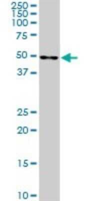 Western Blot: CDK8 Antibody (5H4) [H00001024-M03]