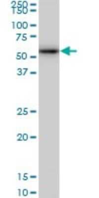 Western Blot: CDK8 Antibody (5H4) [H00001024-M03]