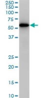 Western Blot: CDK8 Antibody (6E5) [H00001024-M02]