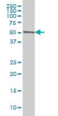 Western Blot: CDK8 Antibody (6H5) [H00001024-M01]