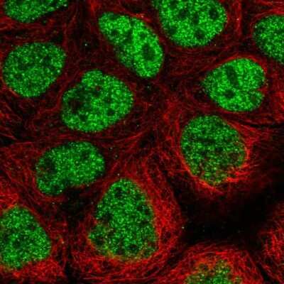 Immunocytochemistry/ Immunofluorescence: CDK8 Antibody [NBP2-55134]