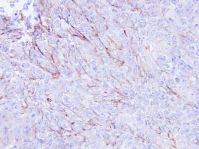Immunohistochemistry-Paraffin: CDKAL1 Antibody [NBP1-32796]