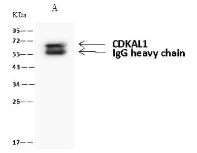Immunoprecipitation: CDKAL1 Antibody [NBP2-98668]