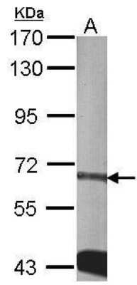 Western Blot: CDKAL1 Antibody [NBP1-32796]