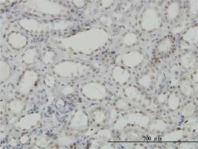 Immunohistochemistry-Paraffin: CDKL1 Antibody (1F12) [H00008814-M03]