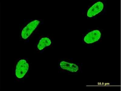 Immunocytochemistry/ Immunofluorescence: CDKL1 Antibody (2H6) [H00008814-M05]