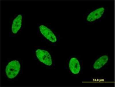Immunocytochemistry/ Immunofluorescence: CDKL1 Antibody (5B11) [H00008814-M01]