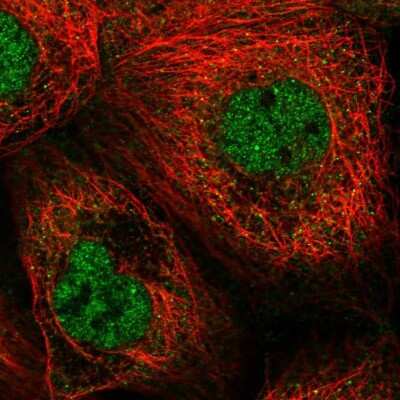 Immunocytochemistry/ Immunofluorescence: CDKL1 Antibody [NBP2-32482]