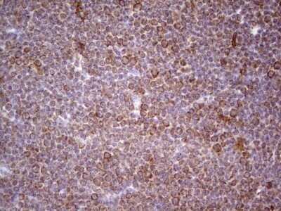 Immunohistochemistry: CDKL1 Antibody (OTI1D9) - Azide and BSA Free [NBP2-71389]