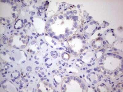 Immunohistochemistry: CDKL2 Antibody (OTI12C2) [NBP2-46218]