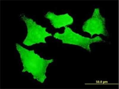 Immunocytochemistry/ Immunofluorescence: CDKL2 Antibody (1F6) [H00008999-M01]