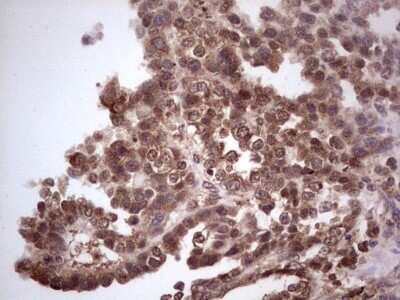 Immunohistochemistry: CDKL2 Antibody (OTI12C2) - Azide and BSA Free [NBP2-71406]