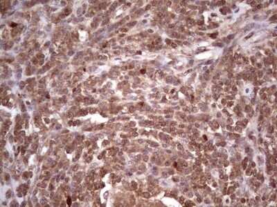 Immunohistochemistry: CDKL2 Antibody (OTI12C2) - Azide and BSA Free [NBP2-71406]