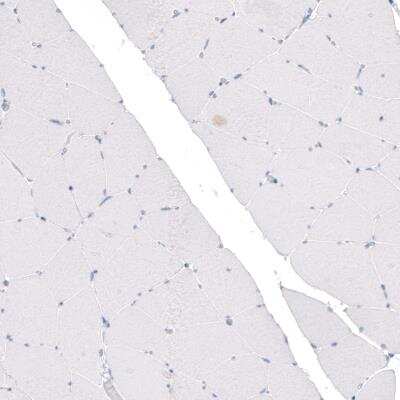 Immunohistochemistry: CDKL5 Antibody (CL4881) [NBP2-61145]