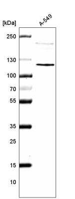 Western Blot: CDKL5 Antibody (CL4888) [NBP2-61146]