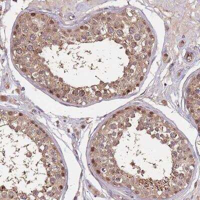 Immunohistochemistry-Paraffin: CDKN2A Interacting protein N-Terminal Like Antibody [NBP2-14466]