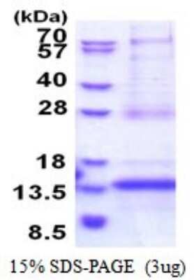 SDS-PAGE: Recombinant Human CDKN2A Interacting protein N-Terminal Like His Protein [NBP2-51567]