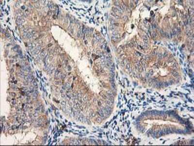 Immunohistochemistry-Paraffin: CDKN3 Antibody (OTI2E11) [NBP2-01245]