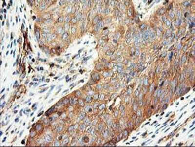 Immunohistochemistry-Paraffin: CDKN3 Antibody (OTI2E11) [NBP2-01245]