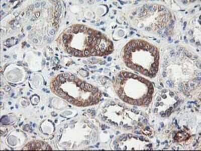 Immunohistochemistry-Paraffin: CDKN3 Antibody (OTI2E11) [NBP2-01245]