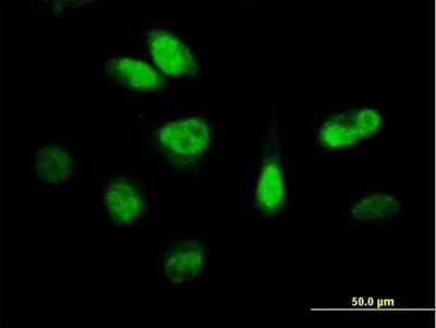 Immunocytochemistry/ Immunofluorescence: CDKN3 Antibody [H00001033-B02P]