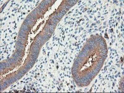 Immunohistochemistry: CDKN3 Antibody (OTI2E11) - Azide and BSA Free [NBP2-70399]
