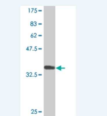 Western Blot: CDO Antibody (2G12) [H00050937-M03]