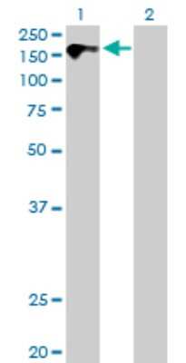 Western Blot: CDO Antibody [H00050937-B01P]